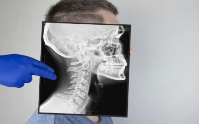 Regulação da Pressão Intracraniana: Implicações para a Terapia Sacro-Craniana