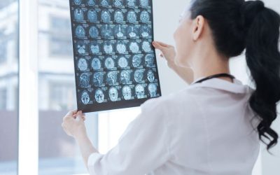 Como a Hipnose Altera a Atividade Cerebral