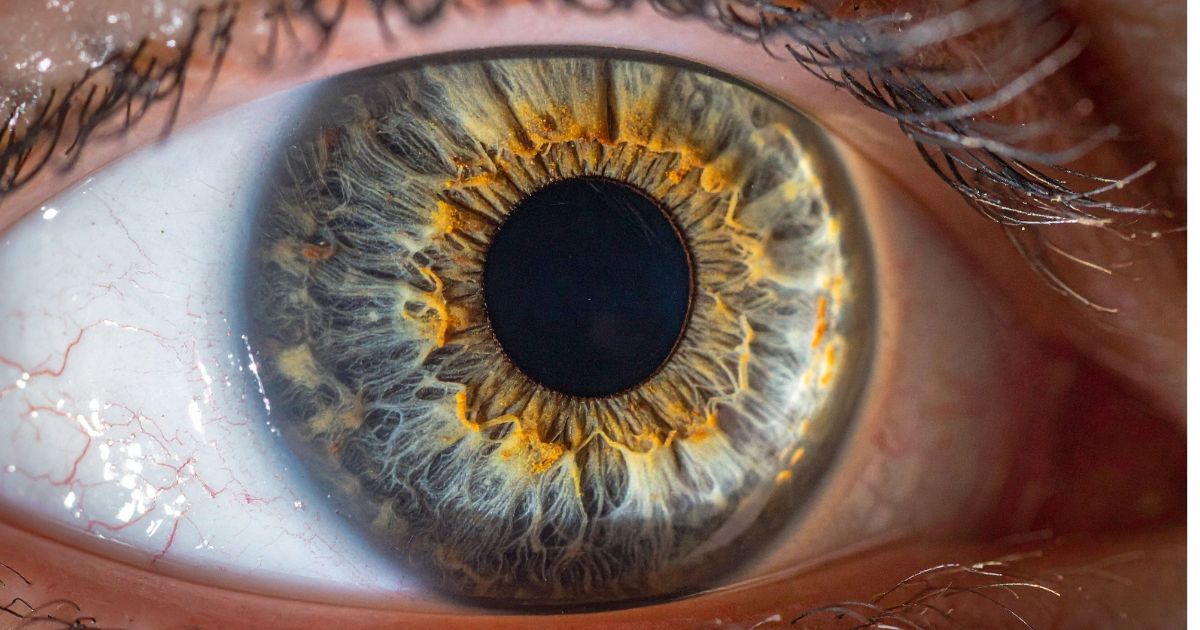 Iris